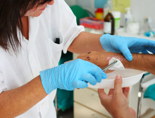 The Evolution of Wound Care